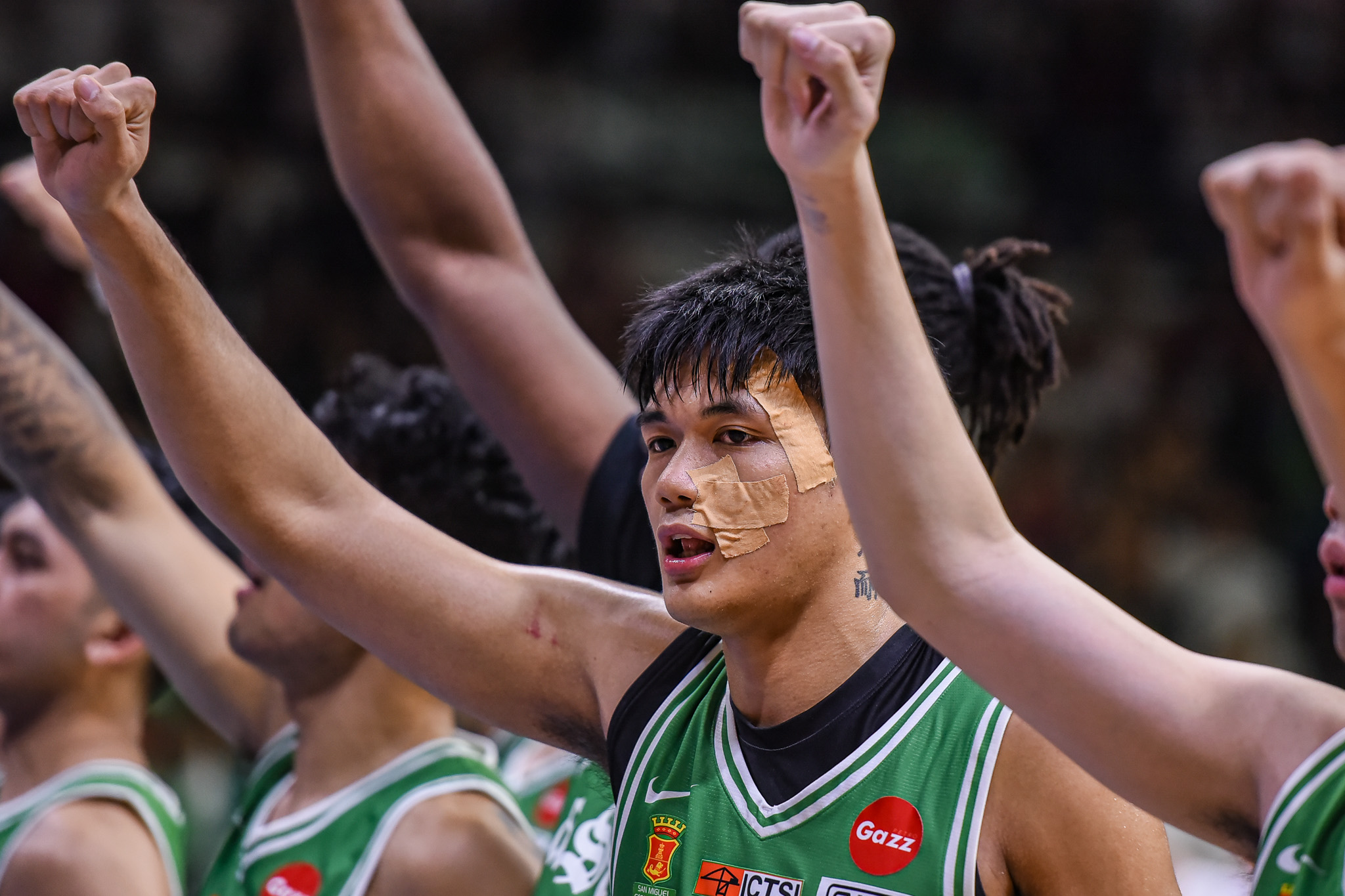 UAAP-88-MBB-DLSU-vs.-UP-Luis-Pablo-8150 Luis Pablo shows battle scars, says 'nothing personal' vs UP Basketball DLSU News UAAP - philippine sports news